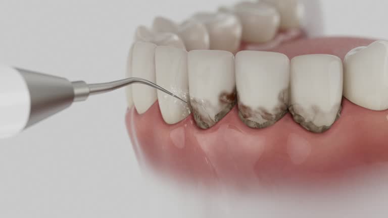 Reliable Dental contractor in Dickson, TN by Smile Center Dentistry